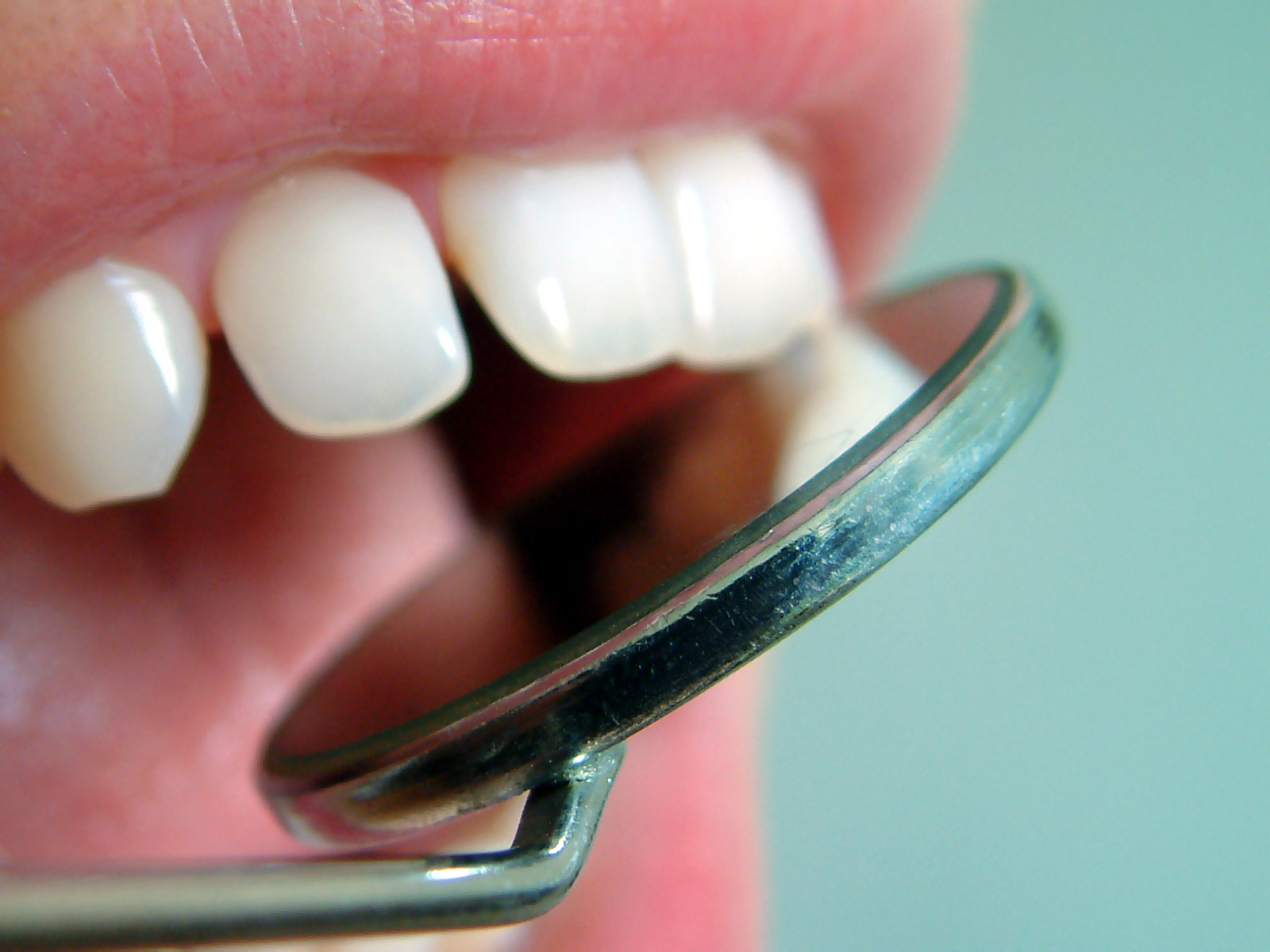 Dental Check Up- more than just teeth.